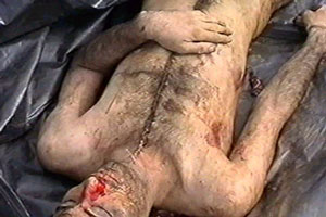 organ ablation on chechens