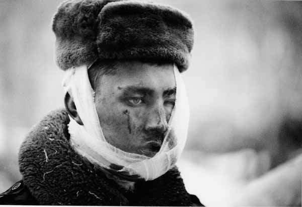 wounded conscript in Chechnya