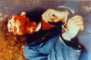 throat cuts in Chechnya